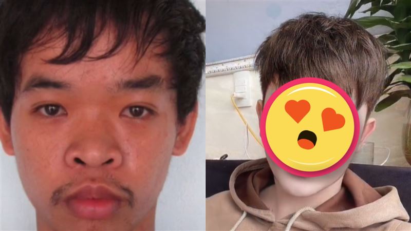 長太醜找不到工作　他整形9次變美男
