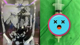 邱鴻傑,醫師,輸尿管結石,腎功能,膿尿。（圖／翻攝自Dr.邱的泌尿健康與旅遊筆記 臉書）