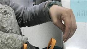 李女士和丈夫爭吵後，手指突然蜷縮，變得像是「雞爪」一樣。（圖／翻攝自《澎湃新聞》）