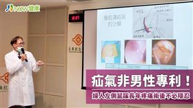 名家專用／NOW健康／嘉義長庚醫院小兒外科主任王世憲提醒，女性也會發生疝氣，如果未不接受手術治療，臨床曾經最嚴重有器官壞死的死亡案例。(勿用)