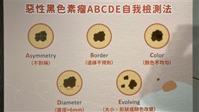 皮膚科醫師提醒，民眾可參考惡性黑色素瘤「ABCDE」自我檢查指標。（圖／記者簡浩正攝影）