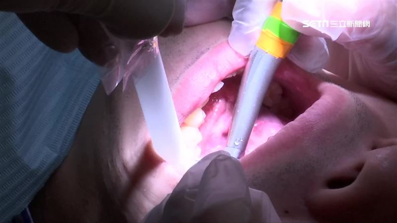 臉腫成豬頭就醫　口腔竟藏「壞東西」