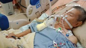 蔡啟芳換.肺2400