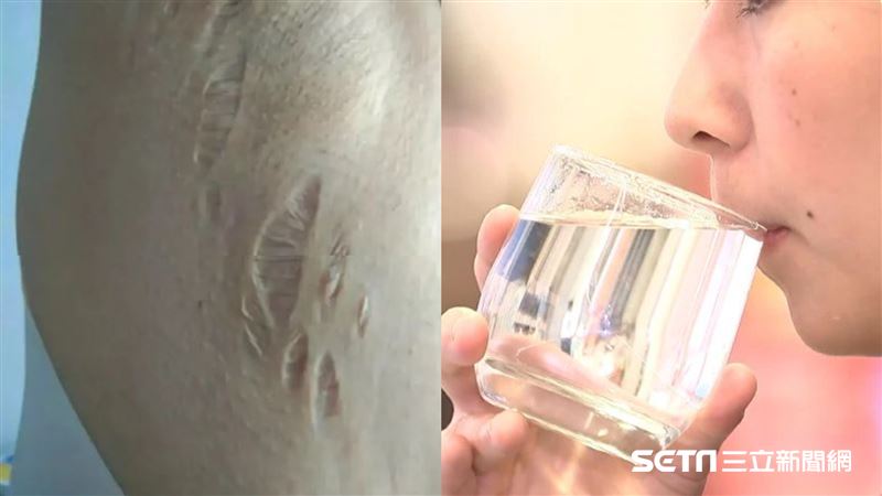 丈夫每天給一杯水！妻一喝罹怪病變形