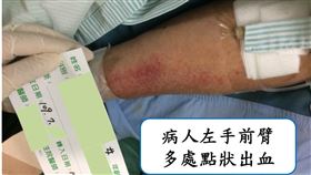 鄭女士傷勢情況（圖／安南醫院提供）