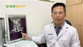 「經頸部內視鏡輔助手術」距離腫瘤位置近，傷口小、出血量低，術後復原快，適合所有甲狀腺手術的病人使用。