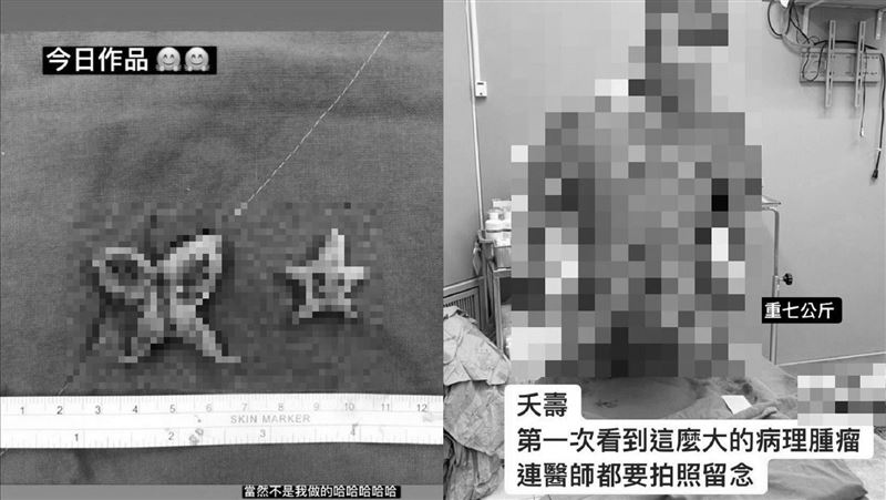 扯炸！護理師再爆PO「軟骨作畫」照