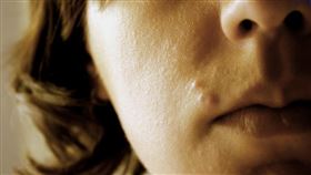 痘痘
https://www.flickr.com/photos/caitlinator/2739337639/in/photolist-5b4PDi-9qoCP9-mnrWKZ-mnrjbt-mnsb9T-mnr9AM-3TycA4-7Zco2P-9VykpB-2iTCB6b-4JjHL7-5iNa7D-AVupZn-xcqFE-AVupfB-dMhEaq-7CiNGL-zYsH9f-2gRg7