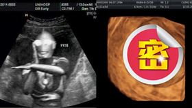 超音波,寶寶,動作,鹹蛋超人,神奇寶貝,媽媽,準媽媽