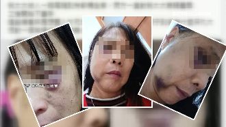 夫控妻遭鄰居毆打　警調監視器秒打臉