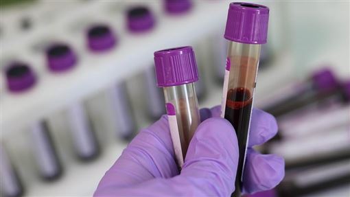 抽血1數據偏高不醫治　恐洗腎、心梗都來