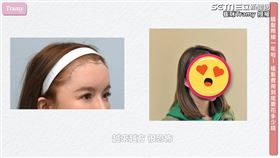 ▲美妝部落客崔咪（Trammy），分享了自己植髮一年的心得。（圖／崔咪Tramy 授權）