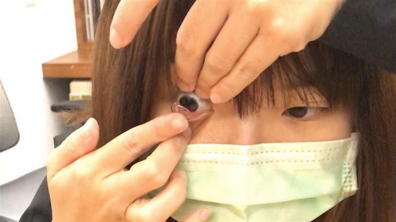 拋棄式隱形眼鏡不合　醫：易假性近視