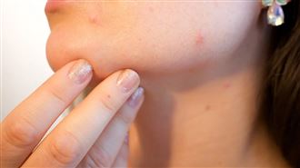 女腿癢2個月是肝癌！皮膚出現4症狀當心了