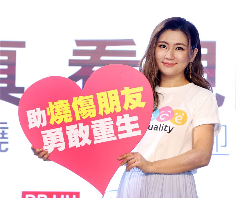 任家萱Selina為陽光基金會募款，助燒傷者重返人生舞台。（記者邱榮吉/攝影）