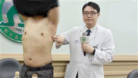 求學時遭霸凌留陰影　男想「被保護」自打3公升沙拉油豐胸（圖／彰基提供）
