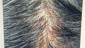 阮綜合醫院頭皮外科（圖／阮綜合醫院提供）