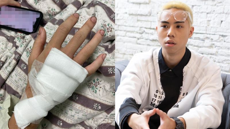 男星右腿腓骨見血　驚悚傷勢曝光