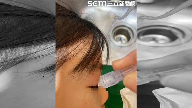 獨／台中母女逛百貨　女童慘叫眼險瞎