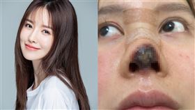 高溜,毀容,毀約,醫美,微整,隆鼻,罰款