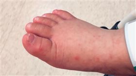 腸病毒／來講兒科急診的543-吳昌騰醫師授權提供