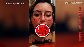 手術舌頭切兩半　超靈活「舌頭拍手」