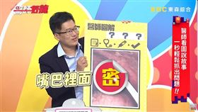 扁桃腺結石（醫師好辣）