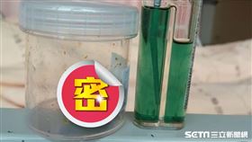 膽結石（韓先生授權）