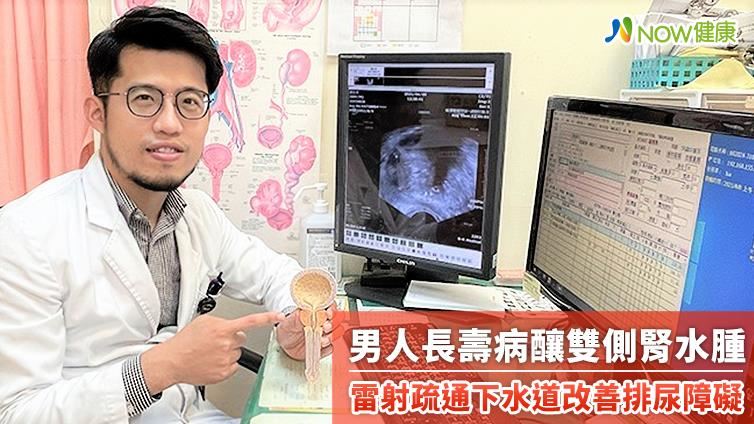 男人長壽病釀雙側腎水腫　用雷射疏通