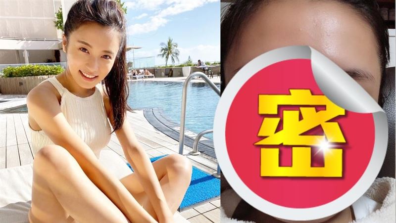 真的崩壞！女星拔智齒慘變「正方臉」