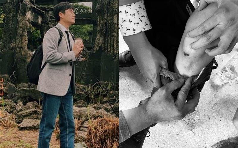拍戲受傷拒就醫　男星親曝原因網讚爆