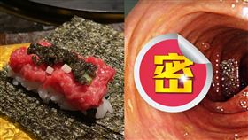  蕭慕琦,醫師,外科,外國人,生肉,絛蟲。（圖／蕭慕琦醫師授權提供）