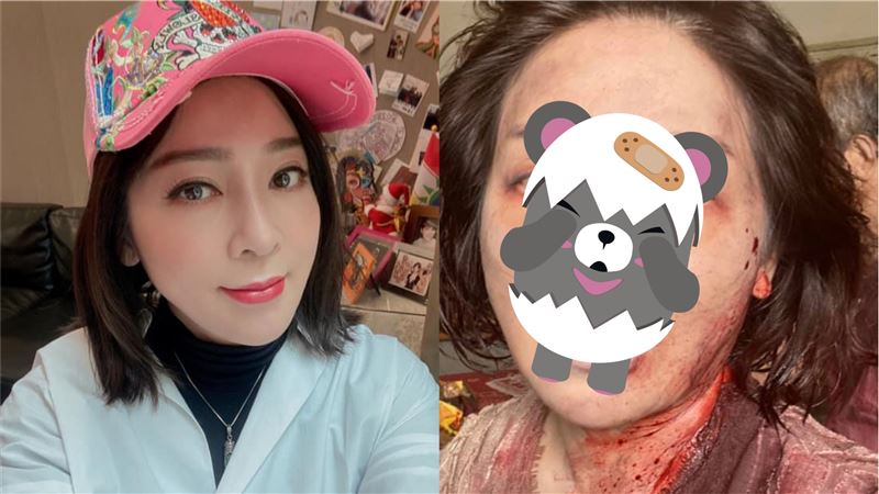 王彩樺曬噴血兇照　驚悚活屍嚇壞粉絲