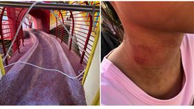 苗栗公園溜滑梯變斷頭台！女童脖瘀青（圖／翻攝自苑裡串起來社團）