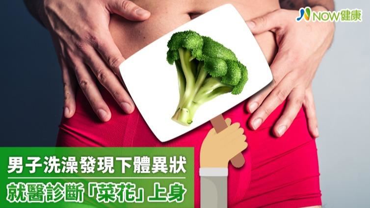 洗澡時發現下體出現異狀嚇傻