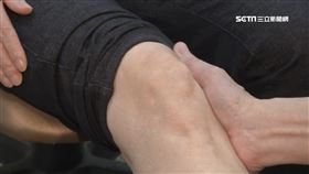 膝軟骨細胞層片