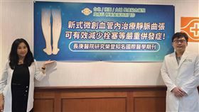 靜脈曲張嚴重恐害命  研究：肺栓塞風險高近倍長庚醫院一項研究發現，靜脈曲張患者肺栓塞風險是常人的1.72倍，恐危及性命；長庚醫院皮膚科醫師張學倫（右）27日在記者會中呼籲，若腿部暴青筋且已呈現一團一團凸起的嚴重靜脈曲張患者，應儘早就醫治療。中央社記者張茗喧攝  110年4月27日