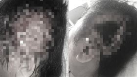 電鍋燙,高雄,茄萣,燙傷