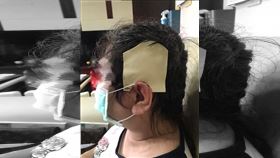 電鍋燙,高雄,茄萣,燙傷