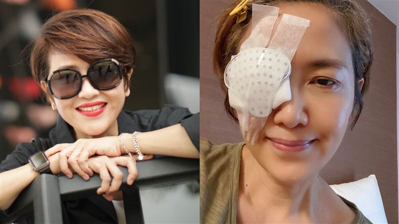 罹青光眼神經壞死　阿嬌憂看不見崩潰
