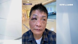 獨家／男酒醉遭壓制　怒控警執法過當