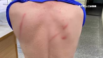 男佯裝刑警搶車　翁拒絕慘遭鐵棍毆打