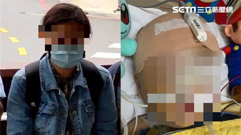 獨／柔道童腦壓再降　母淚：兒快醒來