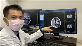 台大醫院導入AI系統，可自動圈選協助醫師找出微小不易發現的腦瘤。（圖／記者簡浩正攝影）