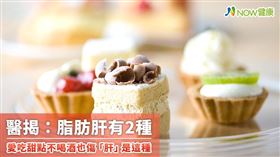 名家專用／NOW健康／現代人飲食較精緻、活動量少， 導致三高症狀、肥胖等現代文明病頻頻找上門，也就容易引發非酒精性脂肪肝。(勿用)
