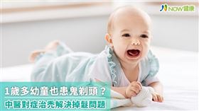 名家專用／NOW健康／有些掉髮症狀不分男女老幼，甚至就連1歲多的小孩，也可能會患有圓形禿、鬼剃頭。(勿用)