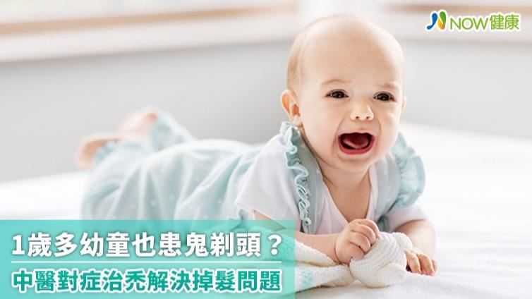 1歲多幼童也患鬼剃頭？