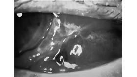 健康食品,抗凝血,阿斯匹靈