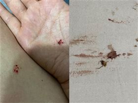 台中防疫旅館是蚊子館，民眾投訴被蚊子大軍叮咬十幾個包，枕頭血跡，衛生局消毒稽查，