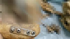 南投,埔里,白骨,特徵,開刀,太陽穴,鋼絲（圖／翻攝畫面）